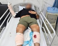 با گلوله پلیس«نوید قره داغی» زمین گیر شد