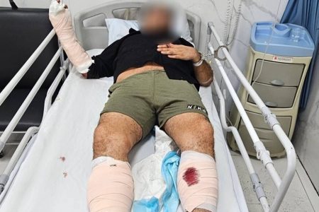 با گلوله پلیس«نوید قره داغی» زمین گیر شد