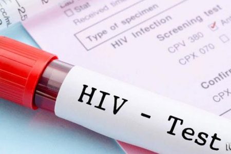 در مبتلایان به HIV ابتلا به کووید ۱۹ کم است